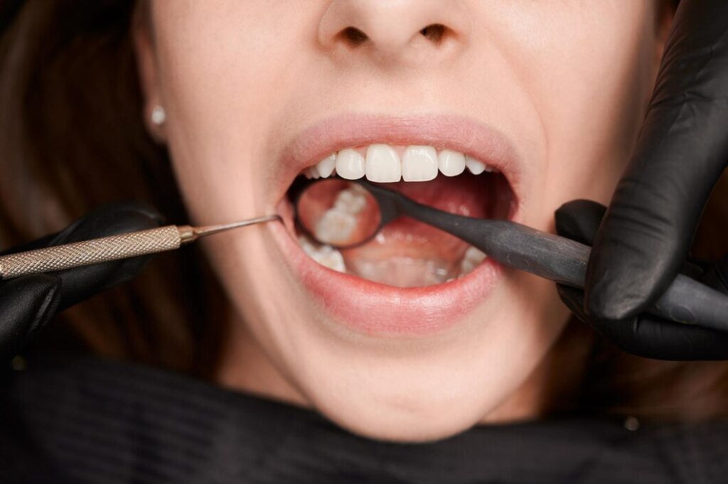 Recurrent cavities